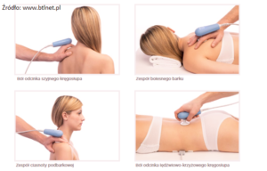 TR Therapy stargard