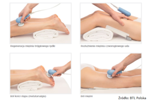 Terapia manualna w Centrum Rehabilitacji Stargard